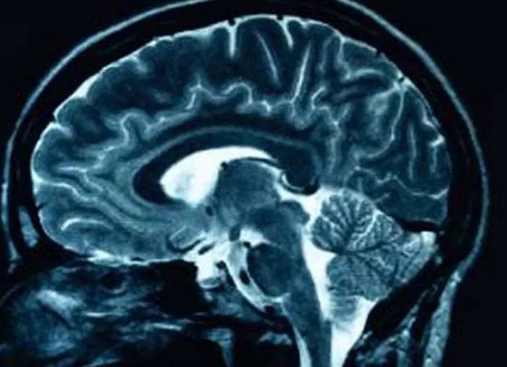 The Long-Term Effects of ADHD on Mental and Physical Health